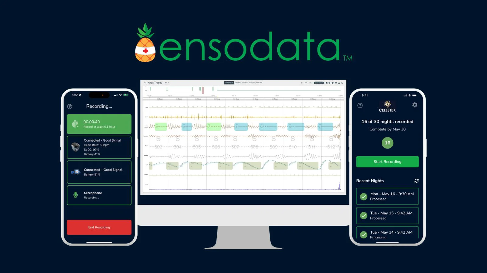 EnsoData AI Sleep