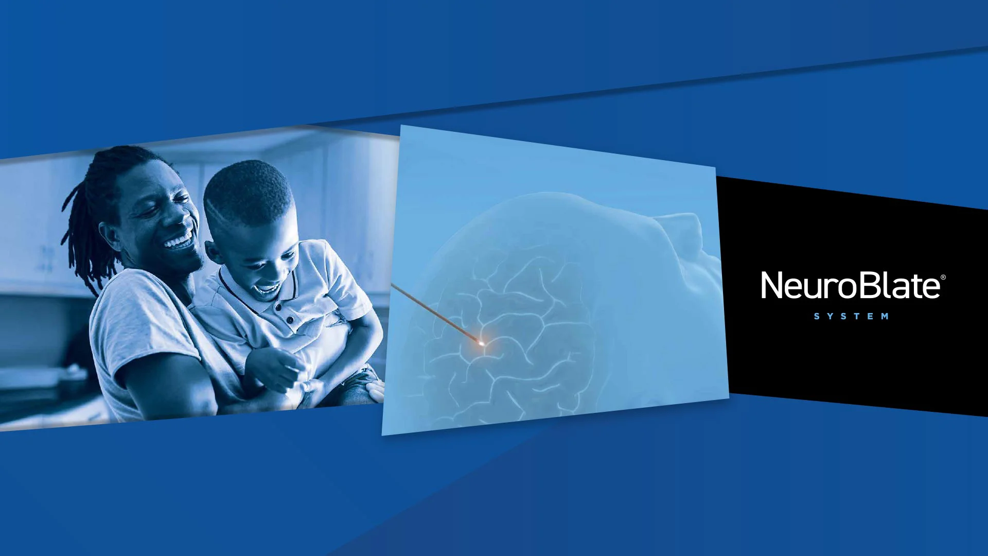 Monteris NeuroBlate