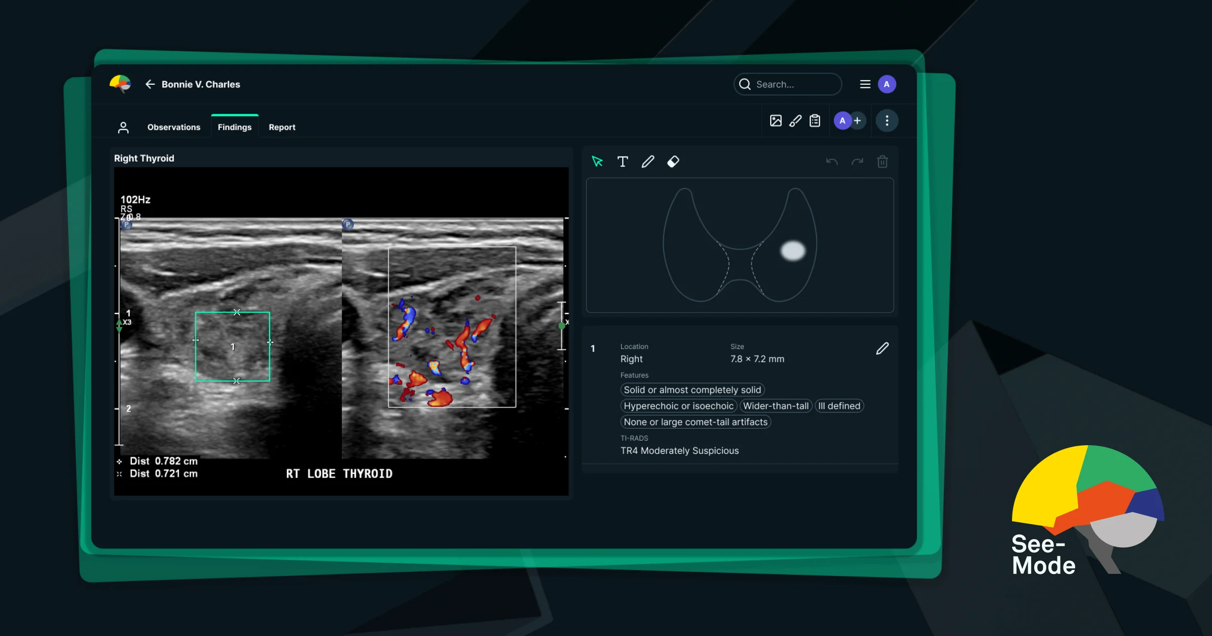 SeeMode Technologies