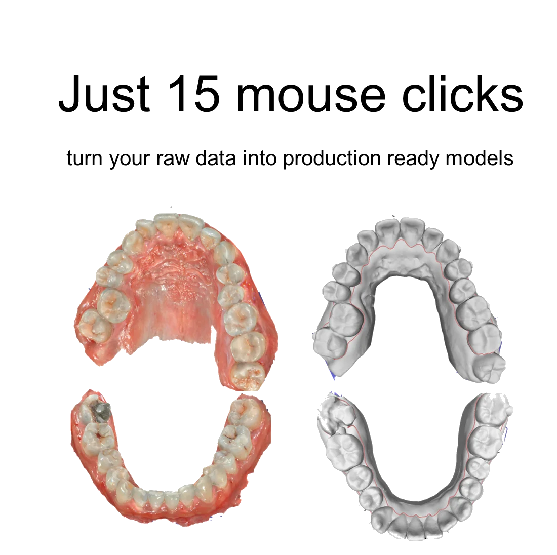 ClearAligner.ai