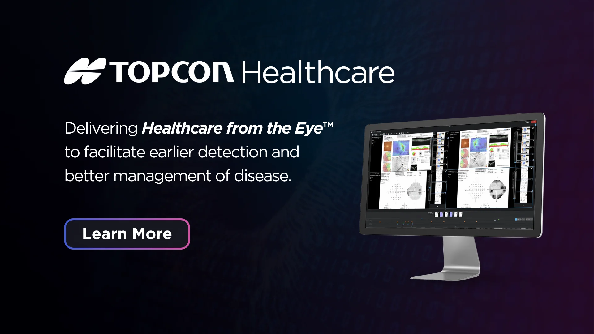 Topcon Camera